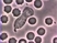 Mikroszkóp alatt: fehérvérsejt akcióban